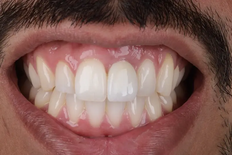 Image 0036-2 Image 0036-2