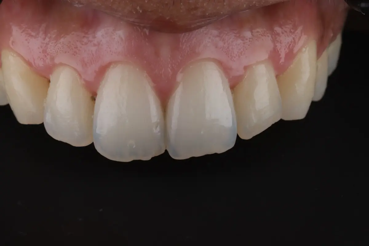 IMG_0377-2 IMG_0377-2