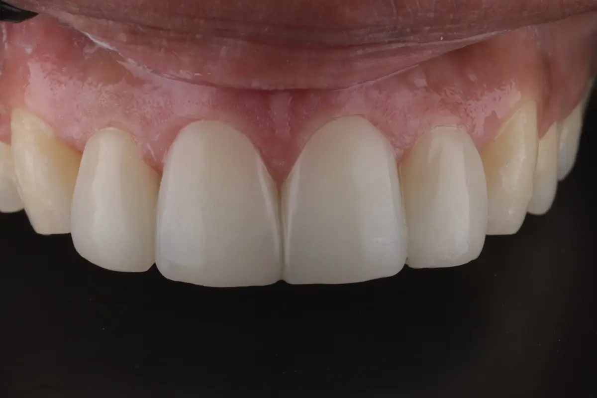 IMG_0394-2 IMG_0394-2