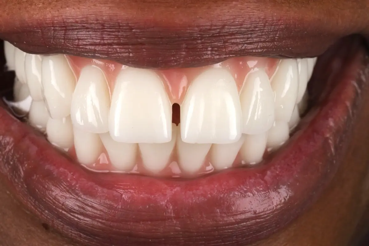 IMG_0831-2 IMG_0831-2