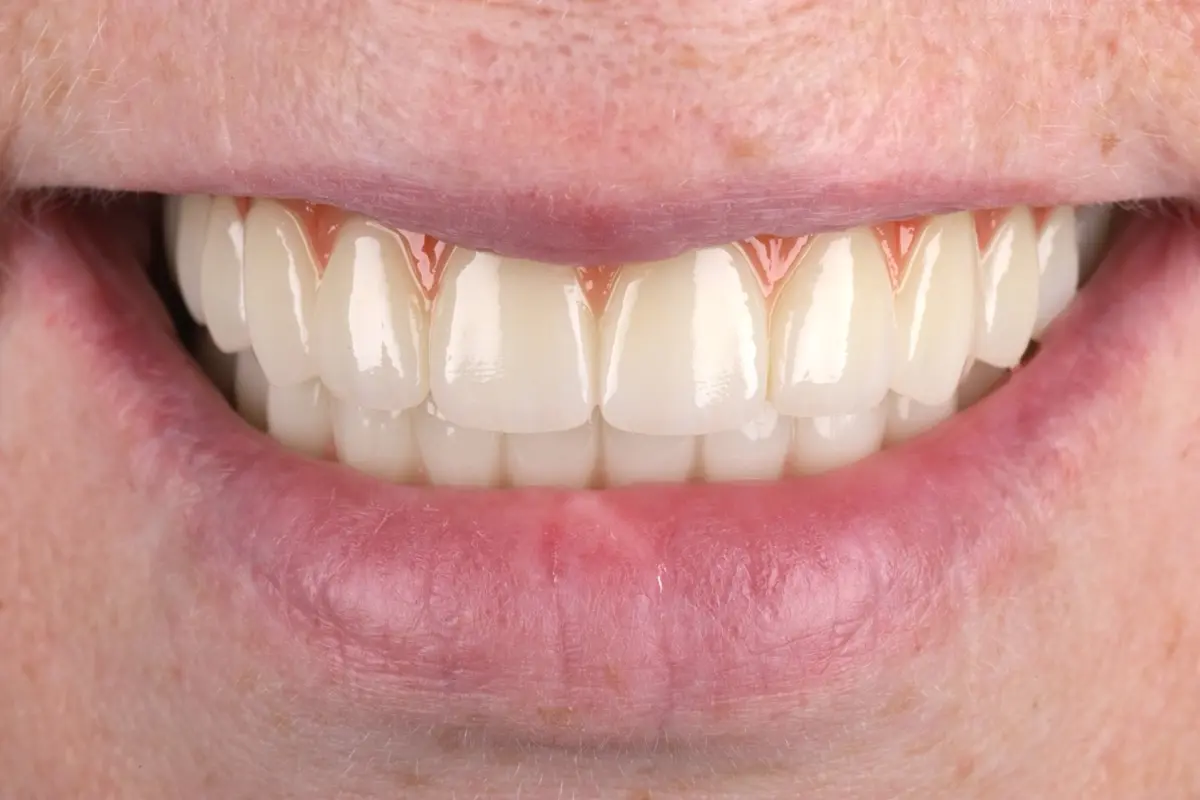 IMG_9558-2 IMG_9558-2