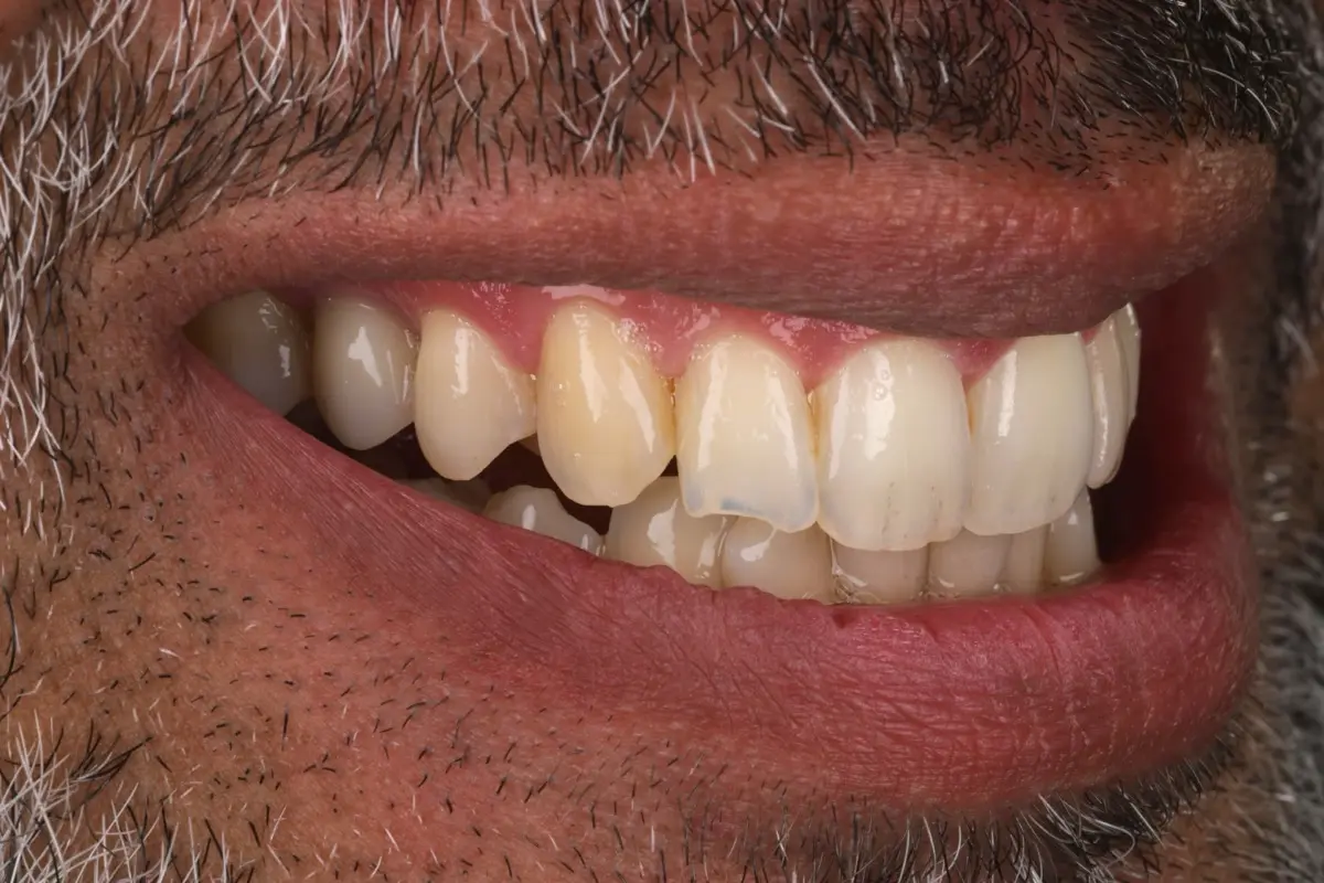 IMG_9919-2 IMG_9919-2