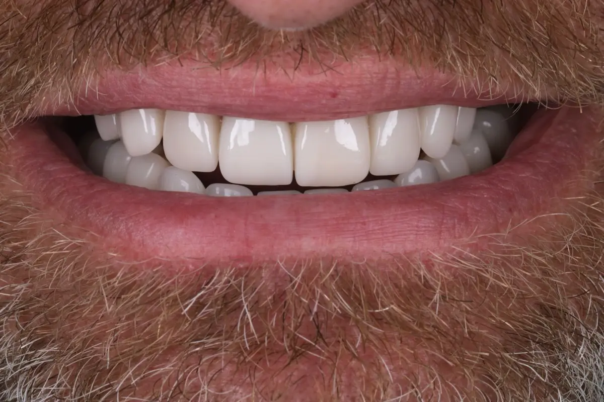 IMG_9944-2 IMG_9944-2