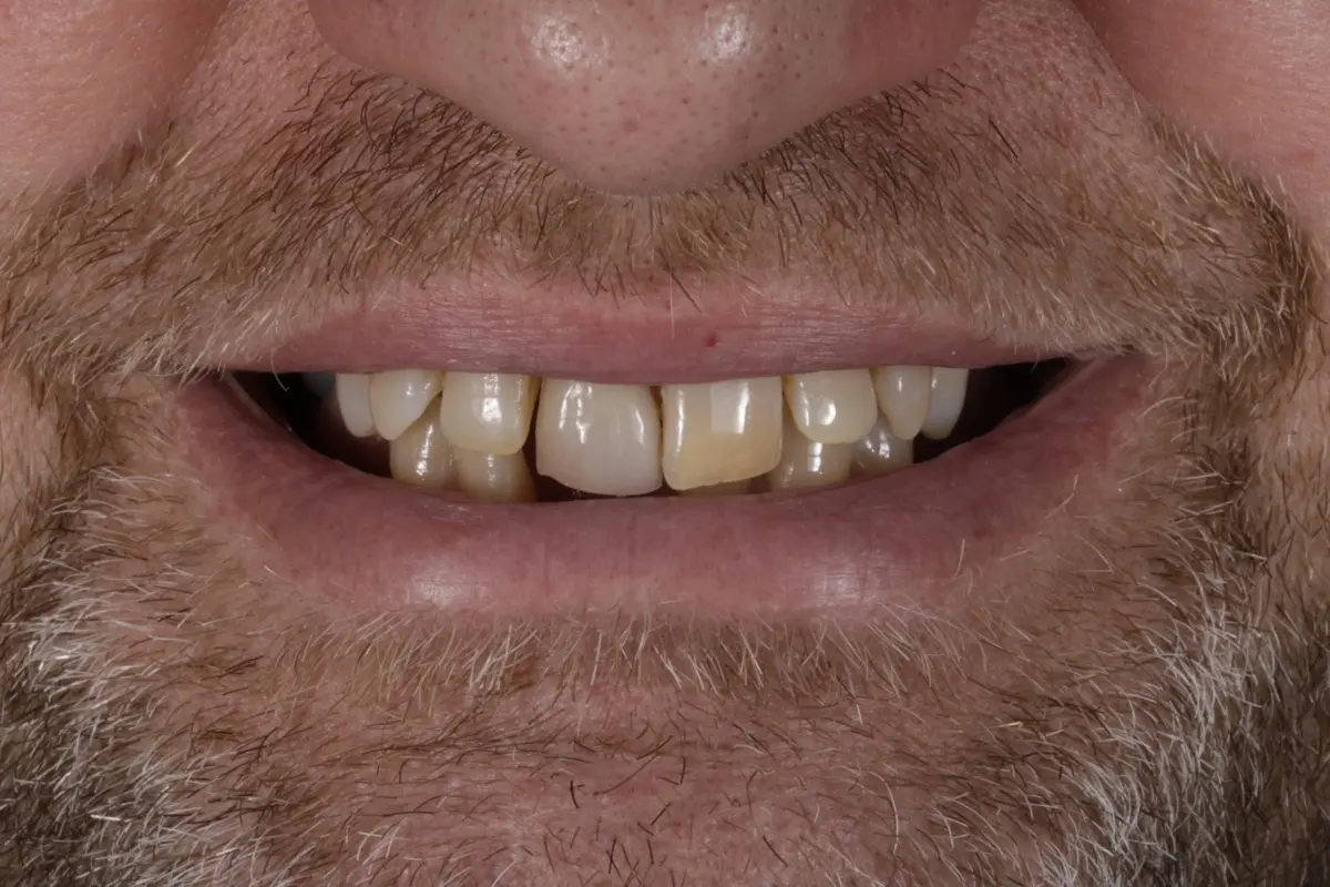 _MG_0122-2 _MG_0122-2