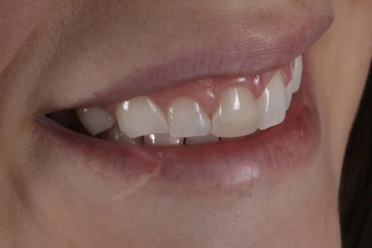 _MG_0228-2 _MG_0228-2