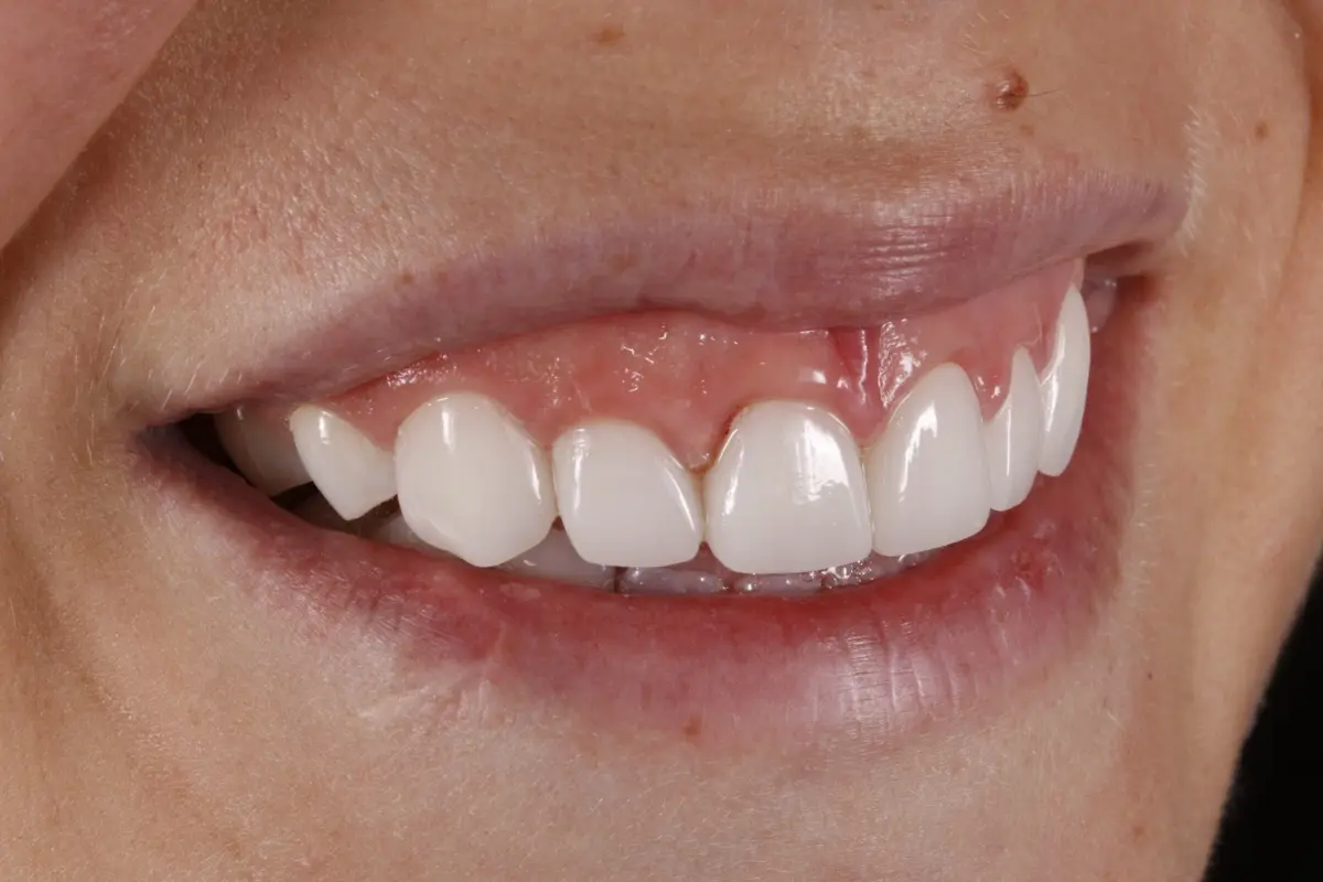 _MG_0731-2 _MG_0731-2