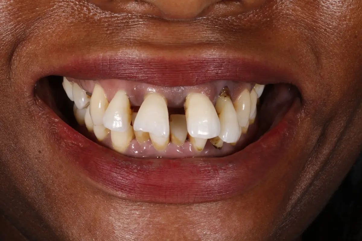 _MG_2374-2 _MG_2374-2