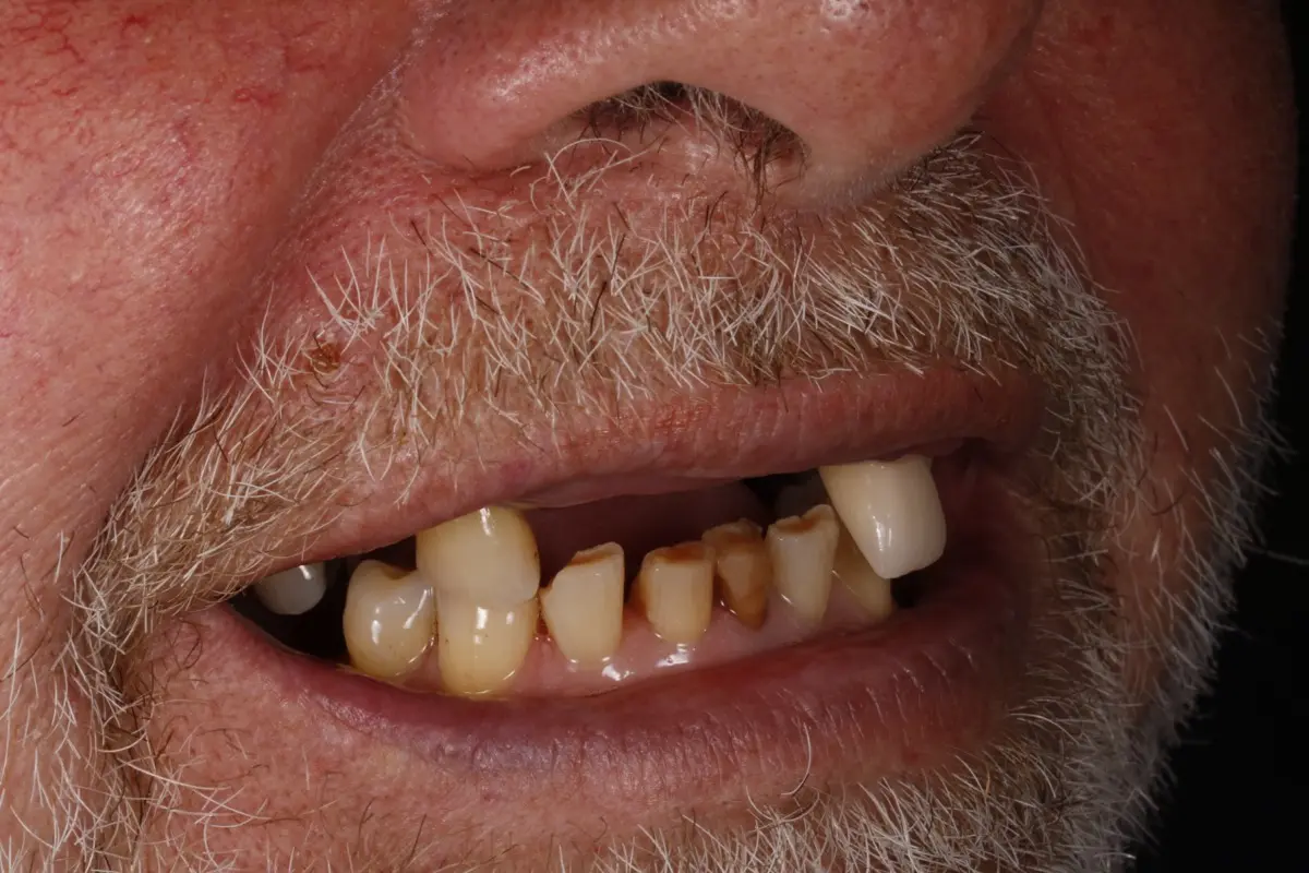 _MG_2496-2 _MG_2496-2