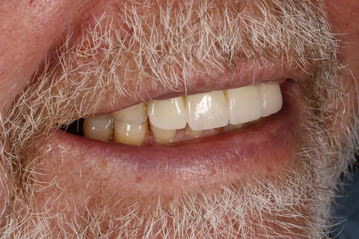 _MG_6817-2 _MG_6817-2