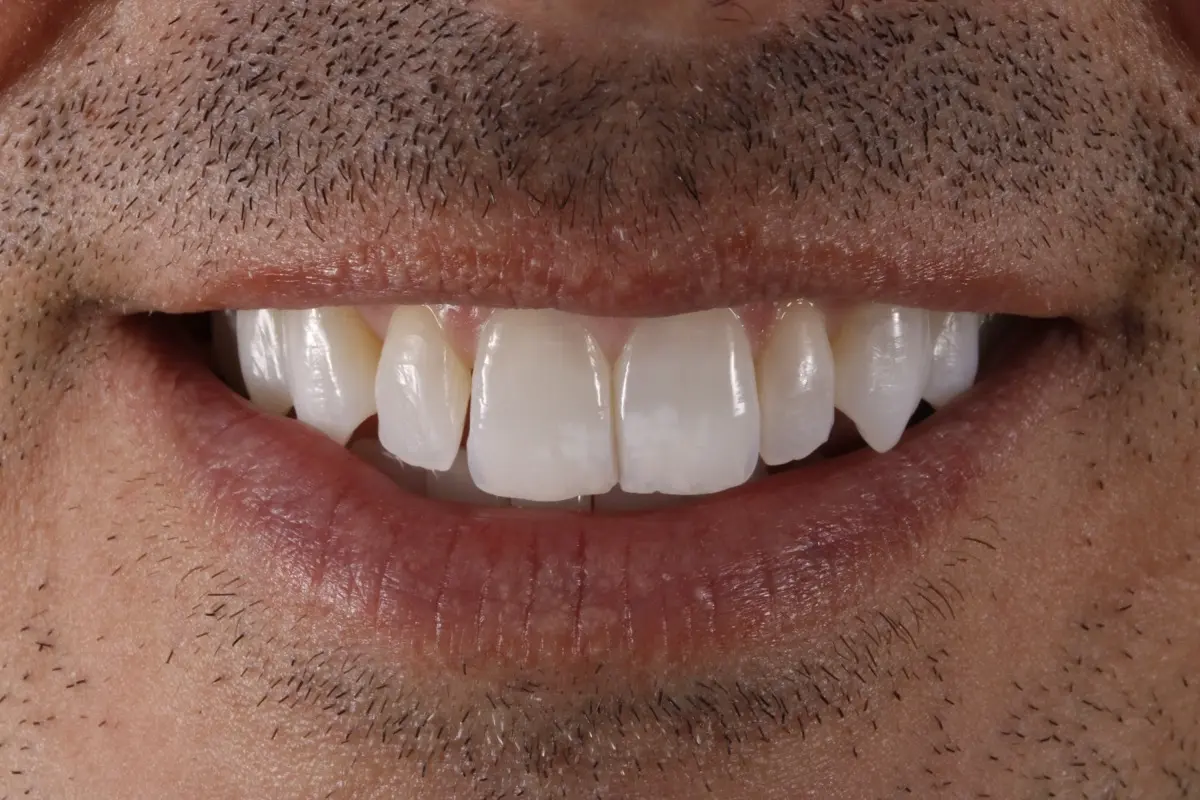 _MG_7010-2 _MG_7010-2