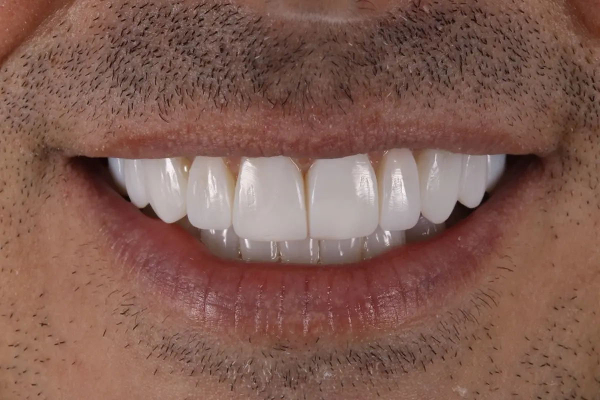 _MG_7041-2 _MG_7041-2