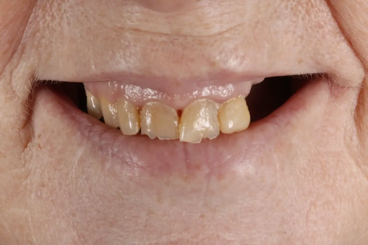 _MG_7904-2 _MG_7904-2