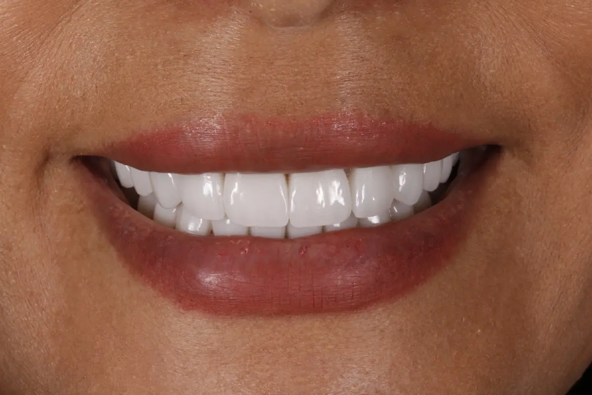 _MG_8735-2 _MG_8735-2