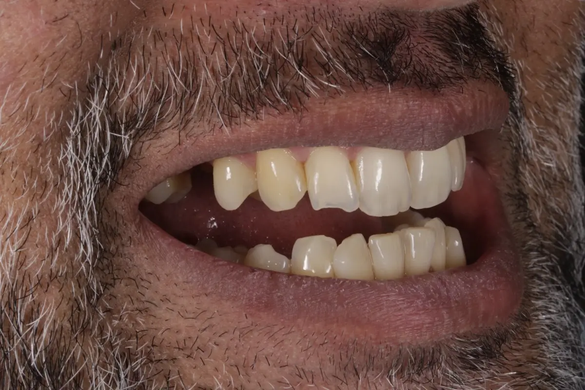 _MG_9607-2 _MG_9607-2